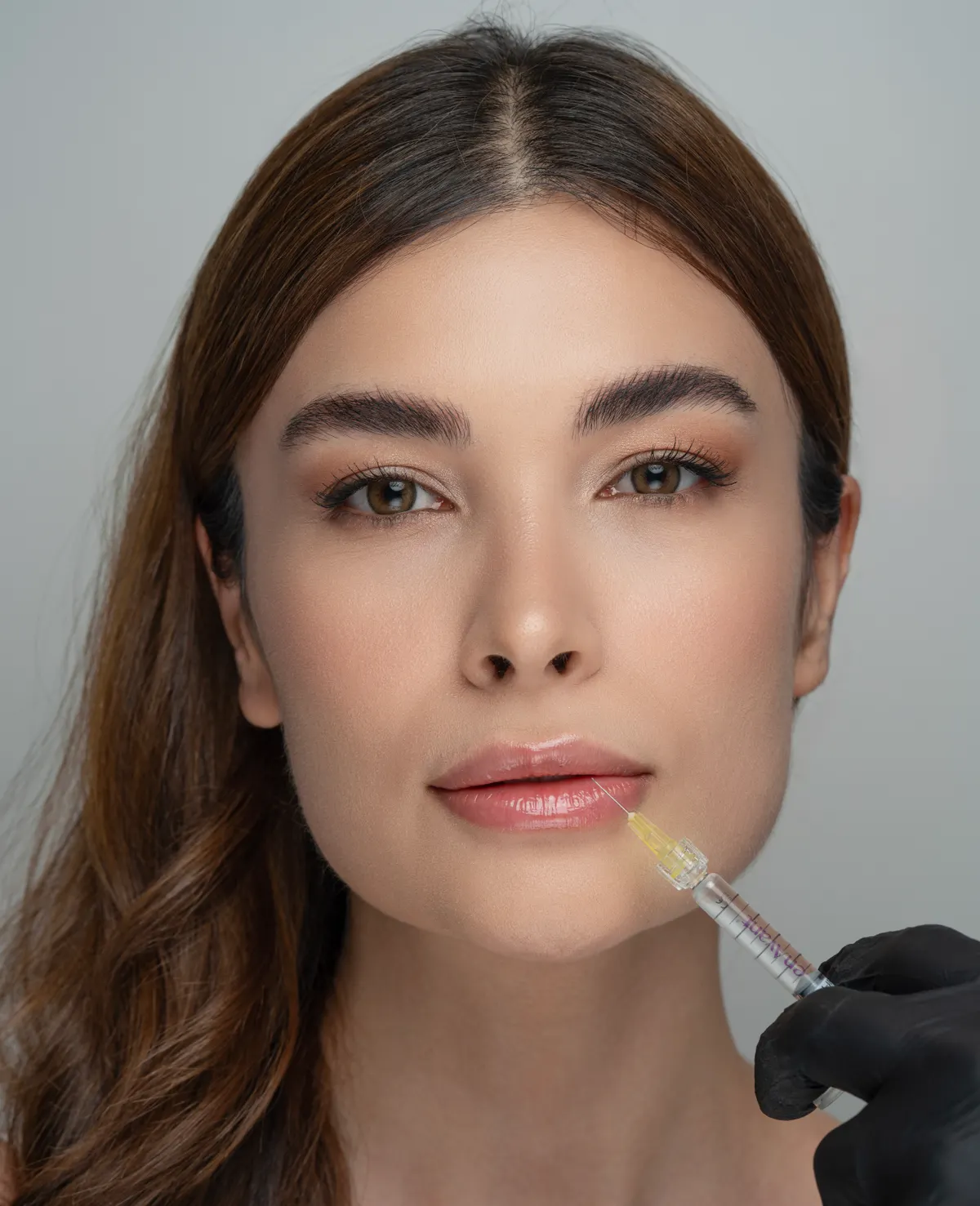 A natural, refined lip enhancement in progress